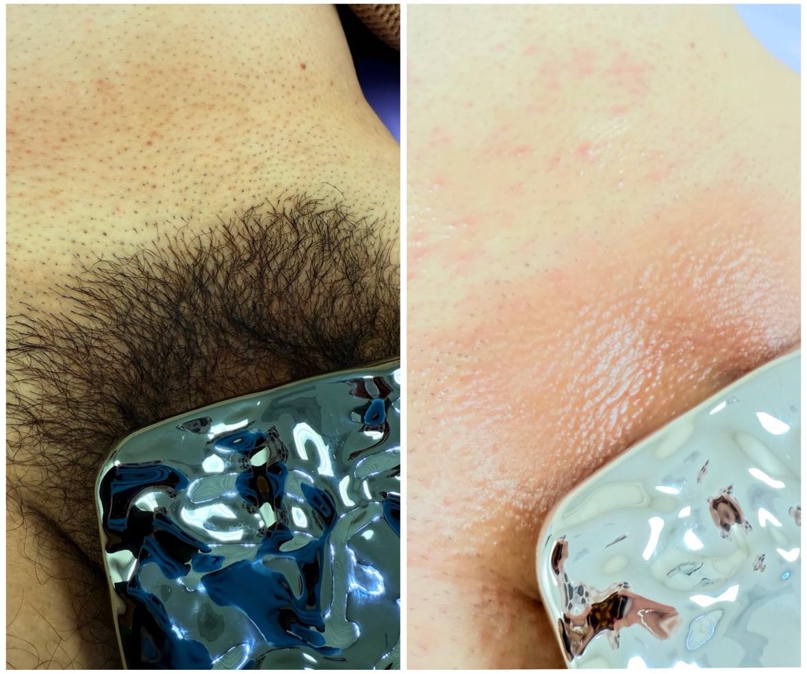 Waxing results Full Circle Beauty